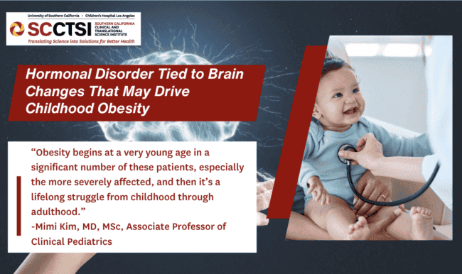 A graphic for SC CTSI, featuring a quote from Mimi Kim, M.D., about obesity in children with congenital adrenal hyperplasia, alongside an image of a healthcare professional examining a child with a stethoscope. 